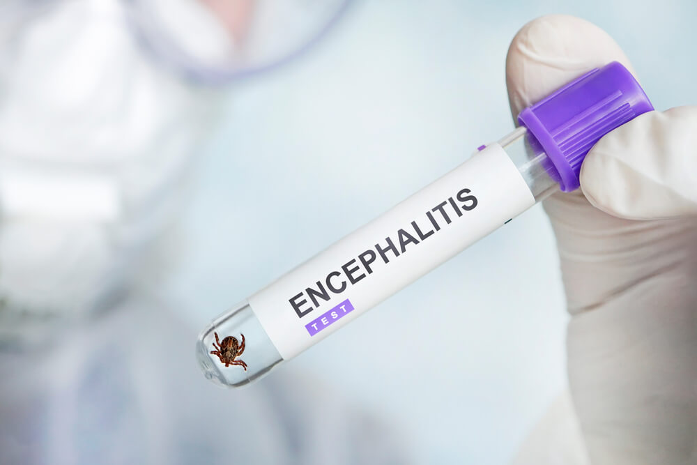 encefalite viral como é feito o diagnostico