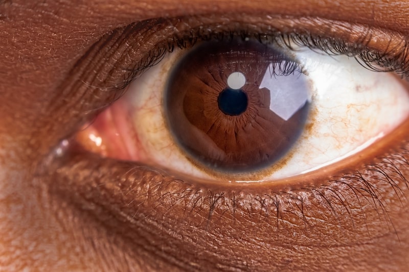 doencas oculares olhos