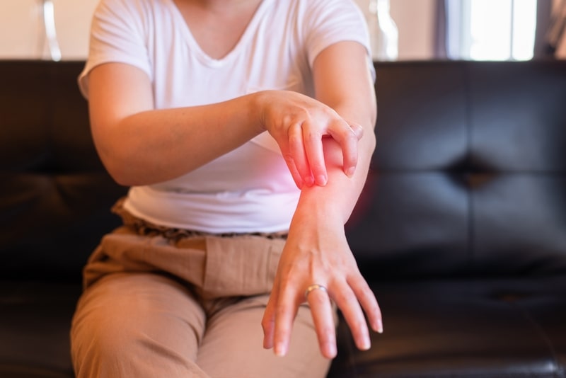 remedio para alergia braco