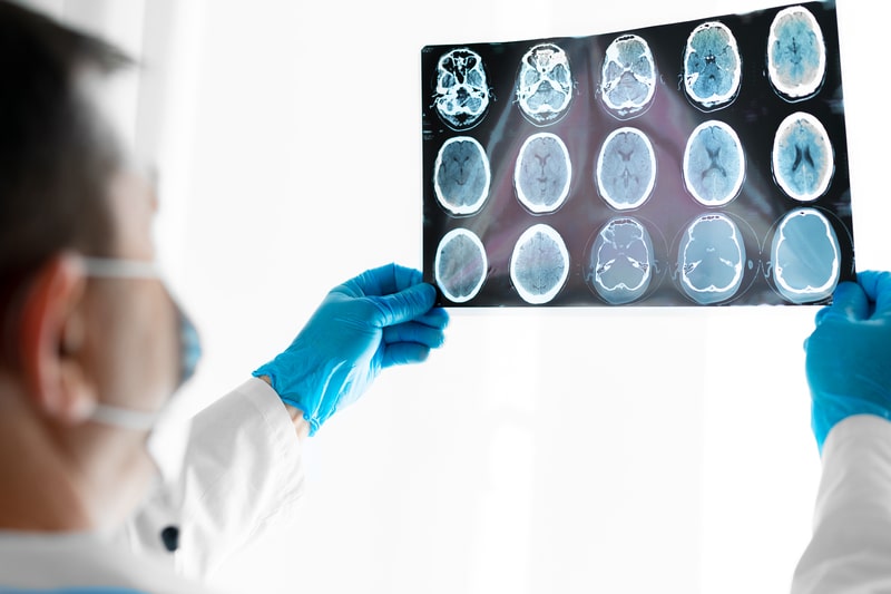 quando consultar um neurocirurgiao raio x