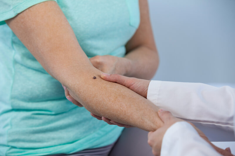 tratamento para cancer de pele tratamento