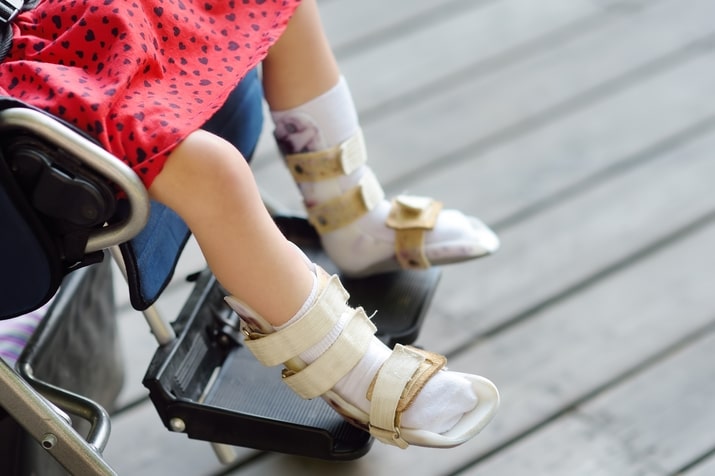 tratamento para paralisia cerebral pernas infantil