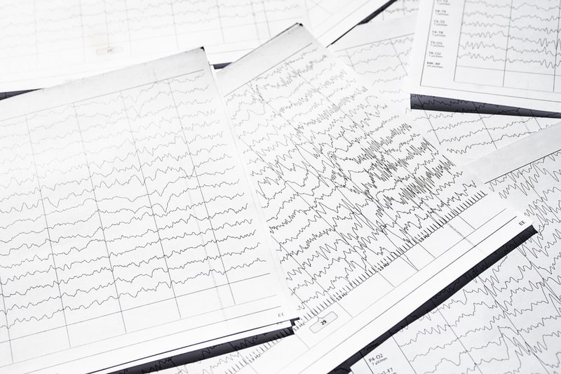 epilepsia exame