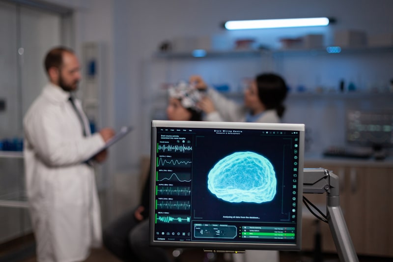 epilepsia diagnostico