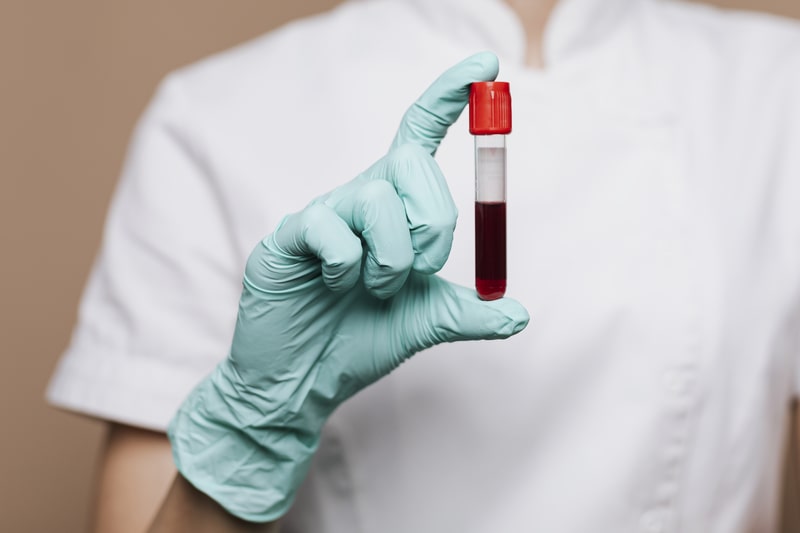 quem fuma maconha pode doar sangue amostra