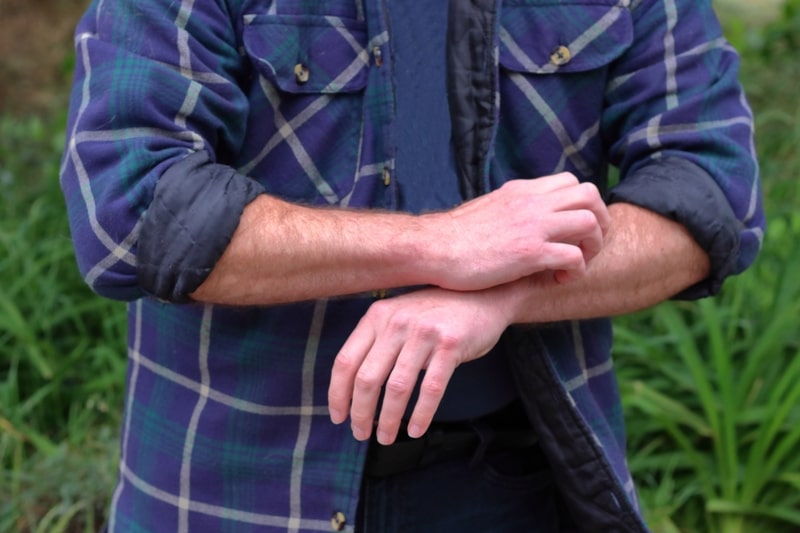 eczema tratamento mulher com coceira
