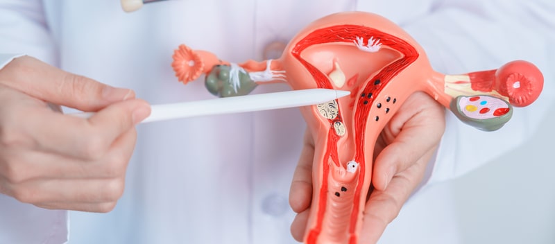 tratamento da endometriose sistema reprodutivo
