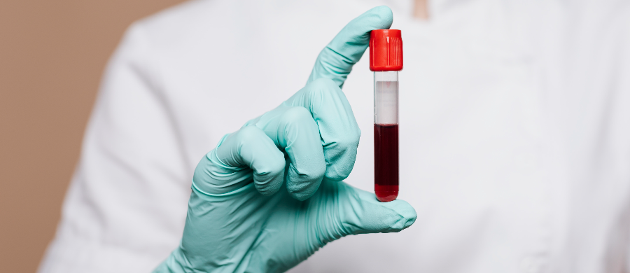 Explorando o potencial terapêutico do CBD em doenças vasculares