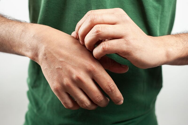 Alergia emocional sintomas
