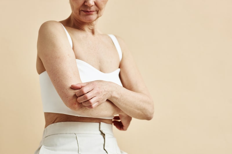 tratamento psoriase coceira