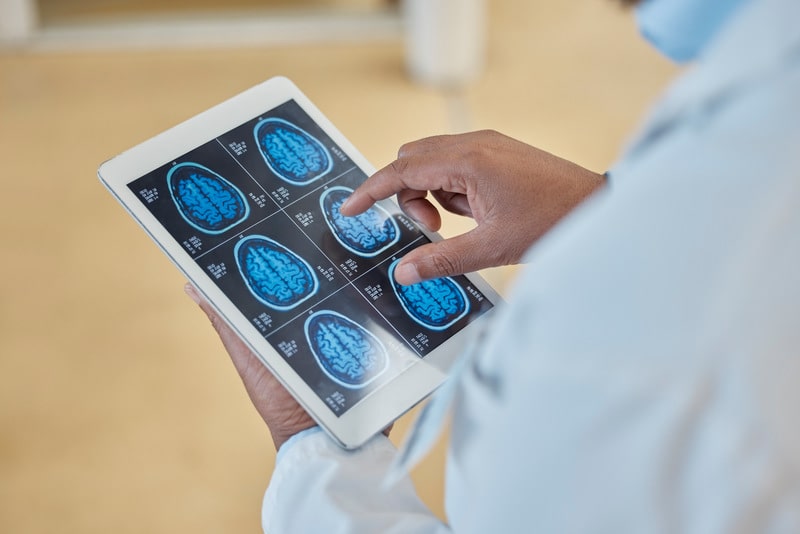 psicocirurgia diagnostico