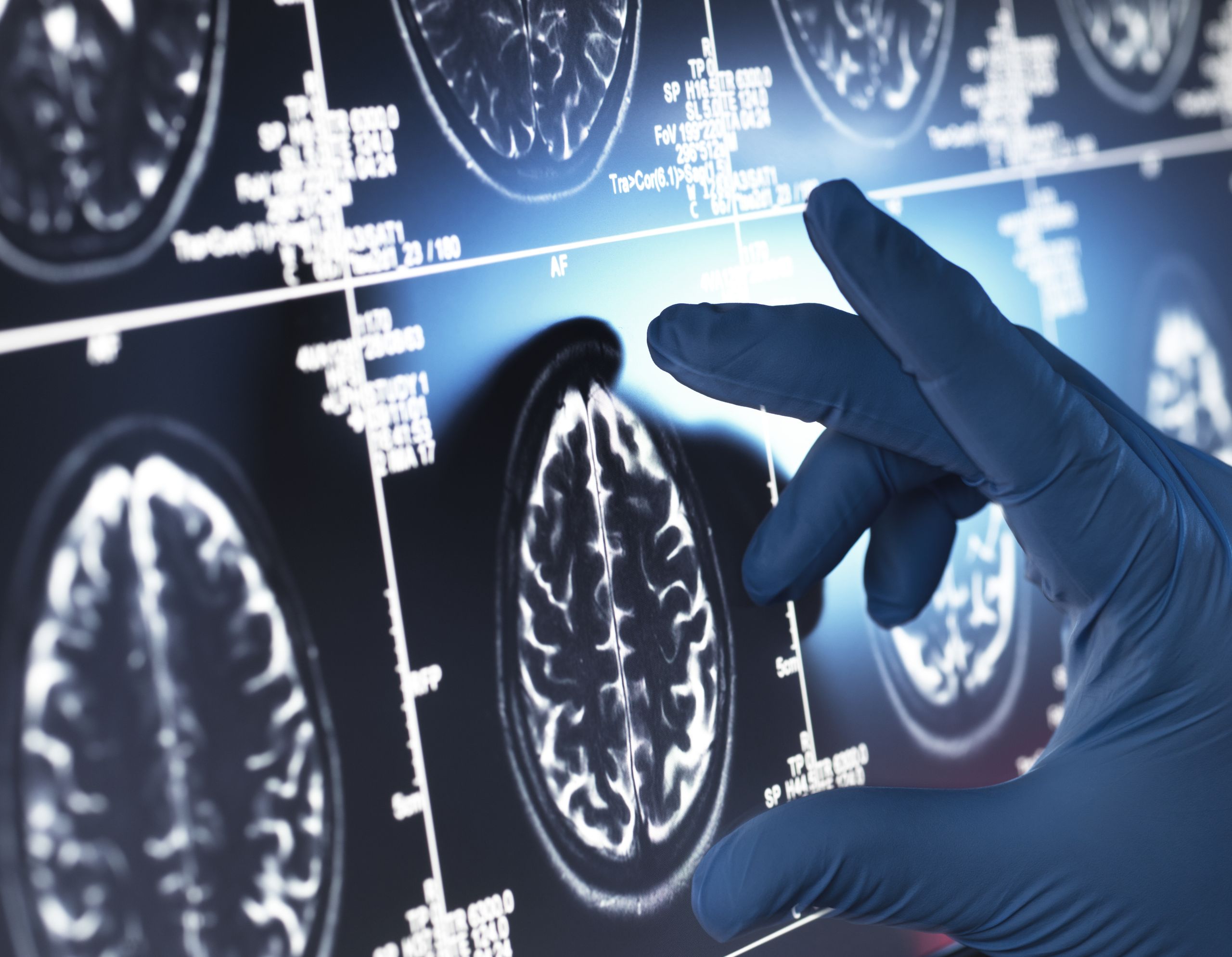 Entenda como o CBD age no corpo e seus benefícios