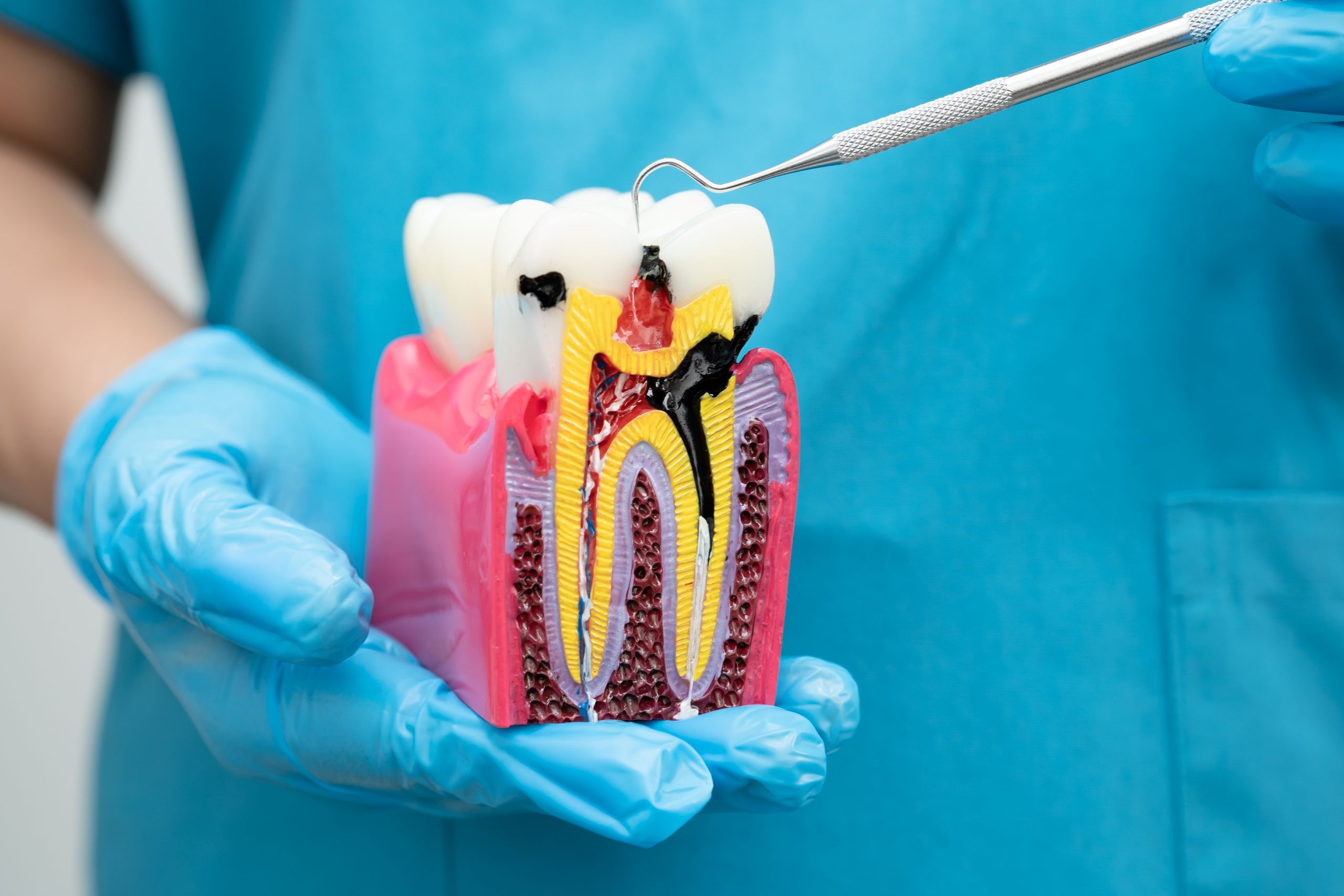 CBD pode ajudar na biomineralização dos dentes, diz estudo