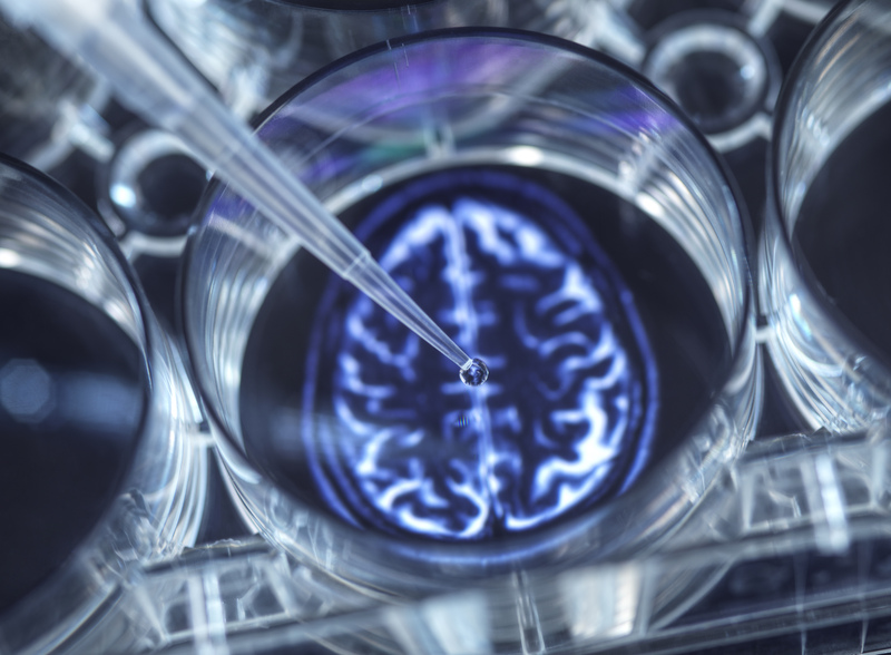 quais sao as doencas neurologicas