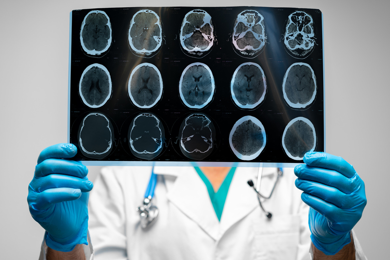 tipos de doencas neurologicas
