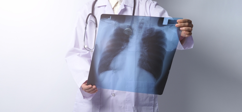 qual e o tratamento da pneumocistose