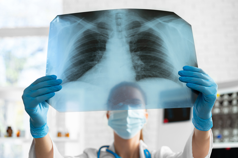 tratamento da pneumocistose como e feito