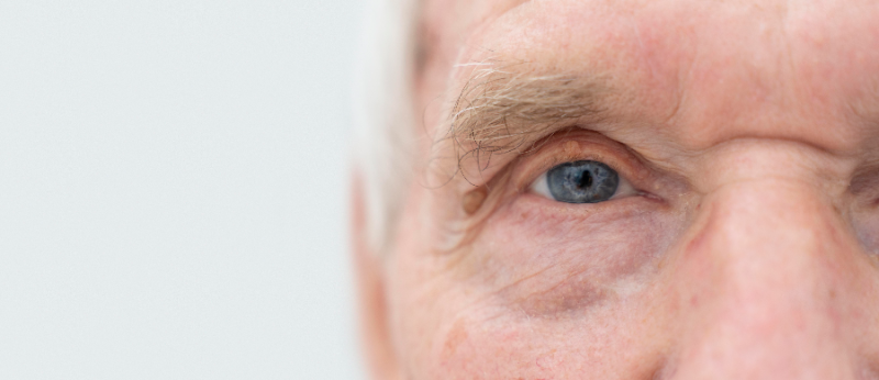 Dia Nacional de Combate ao Glaucoma: Cannabis é uma opção?