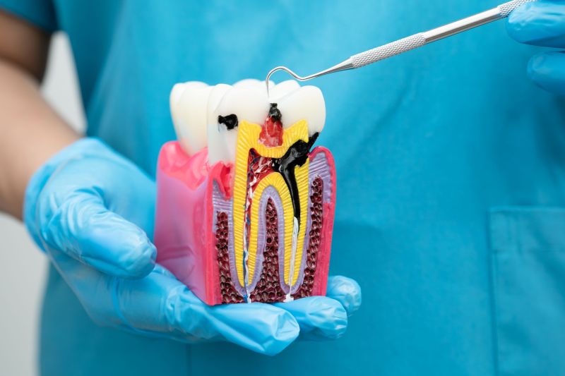 CBD pode ajudar na biomineralização dos dentes, diz estudo