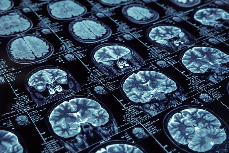 doencas neurologicas