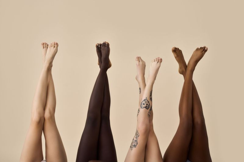 lipedema e cannabis medicinal