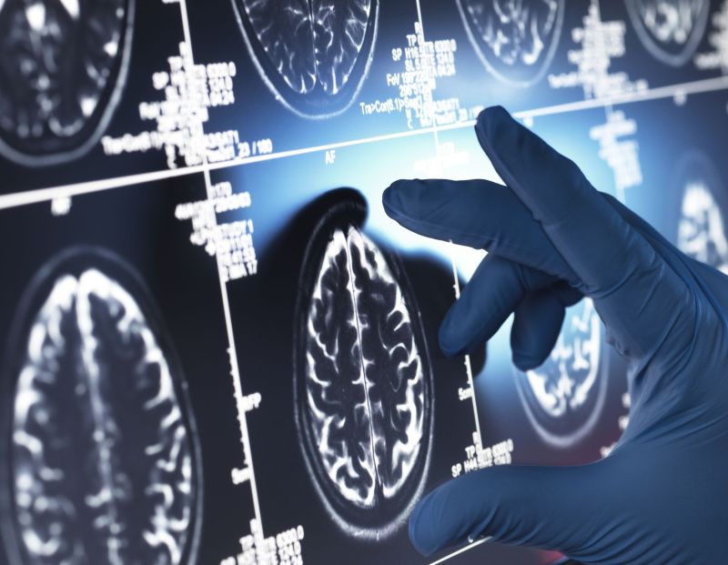 Entenda como o CBD age no corpo e seus benefícios