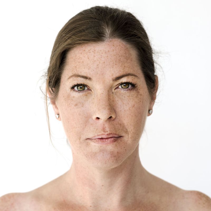 perimenopausa