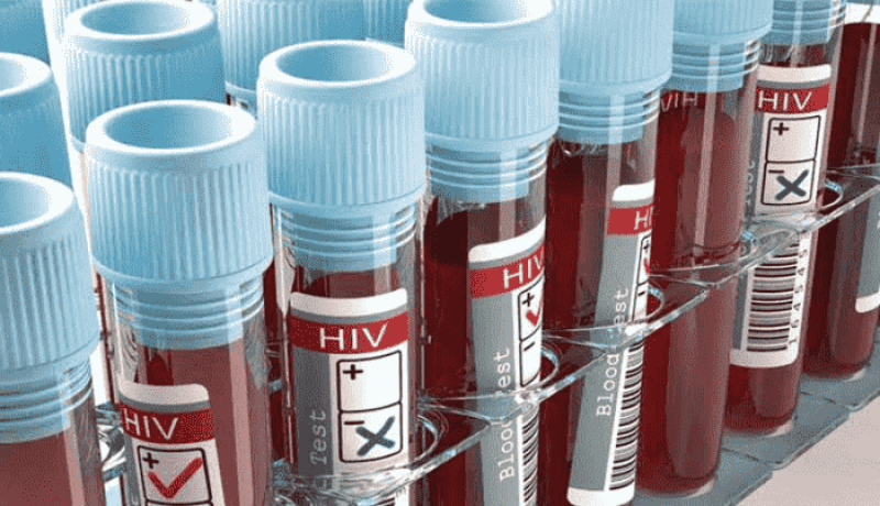 tratamento-da-aids-frascos-de-sangue